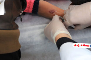 المركز الوطني الليبي لمكافحة الأمراض يعلن عن تواجد أطباء الجلد لعلاج مرض الليشمانيا